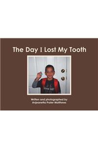 The Day I Lost My Tooth