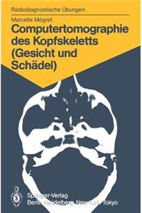 Computertomographie Des Kopfskeletts (Gesicht Und Schädel)