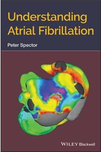 Understanding Atrial Fibrillation