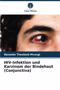 HIV-Infektion und Karzinom der Bindehaut (Conjunctiva)