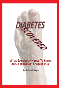 Diabetes Discovered