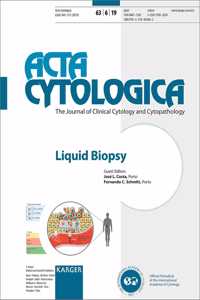 Liquid Biopsy