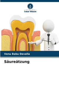 Säureätzung