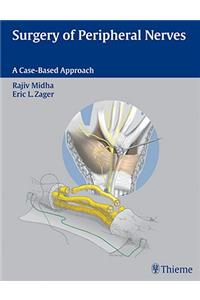 Surgery of Peripheral Nerves