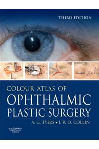 Colour Atlas of Ophthalmic Plastic Surgery with DVD