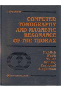 Computed Tomography and Magnetic Resonance of the Thorax