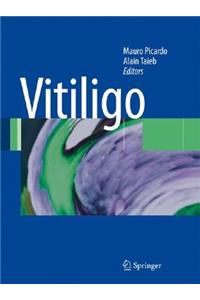 Vitiligo