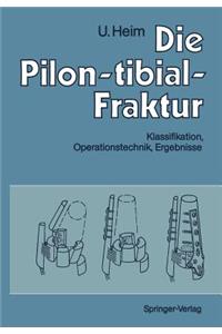 Die Pilon-Tibial-Fraktur