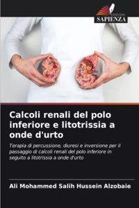 Calcoli renali del polo inferiore e litotrissia a onde d'urto