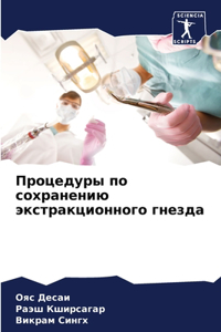 Процедуры по сохранению экстракционного