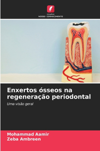 Enxertos ósseos na regeneração periodontal