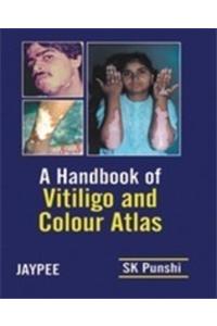 Handbook of Vitiligo and Colour Atlas