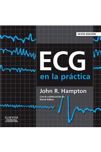 ECG En La Práctica