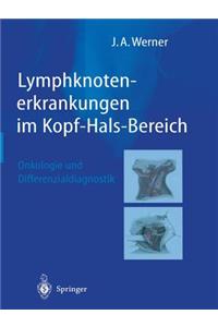 Lymphknotenerkrankungen im Kopf-Hals-Bereich