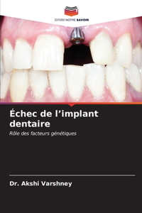 Échec de l'implant dentaire