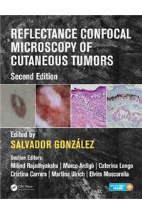 Reflectance Confocal Microscopy of Cutaneous Tumors