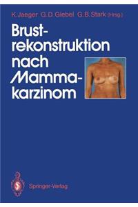 Brustrekonstruktion Nach Mammakarzinom