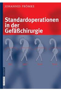 Standardoperationen in Der Gefäßchirurgie