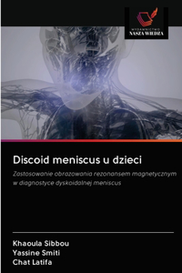 Discoid meniscus u dzieci