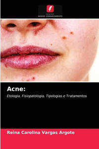 Acne