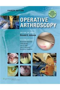 Operative Arthroscopy