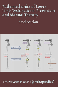 Pathomechanics of Lower Limb Dysfunctions