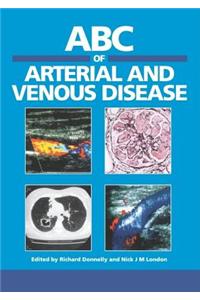 ABC of Arterial and Venous Disease