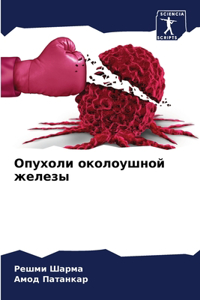 Опухоли околоушной железы