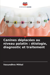 Canines déplacées au niveau palatin