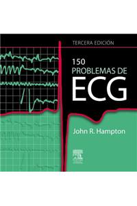 150 Problemas de ECG
