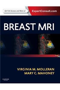 Breast MRI