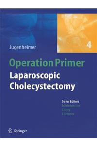 Laparoscopic Cholecystectomy