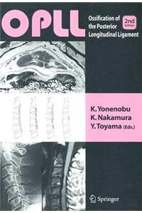 OPLL: Ossification of Posterior Longitudinal Ligament