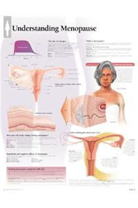 Understanding Menopause Laminated Poster