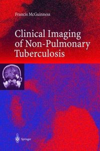 Clinical Imaging in Non-Pulmonary Tuberculosis