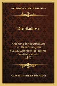 Skoliose