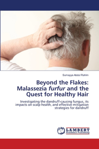 Beyond the Flakes