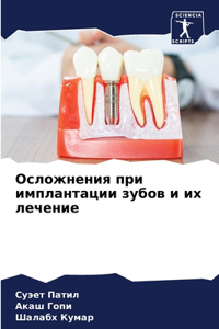 Осложнения при имплантации зубов и их лечk