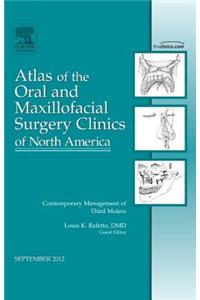 Contemporary Management of Third Molars, an Issue of Atlas of the Oral and Maxillofacial Surgery Clinics