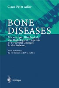 Bone Diseases