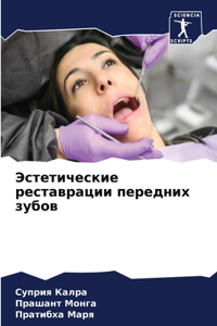 Эстетические реставрации передних зубов