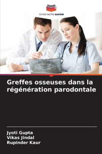 Greffes osseuses dans la régénération parodontale