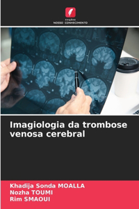 Imagiologia da trombose venosa cerebral