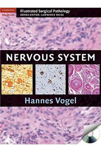 Nervous System