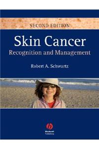 Skin Cancer