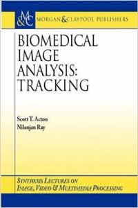 BIOMEDICAL IMAGE: ANALYSIS: TRACKING