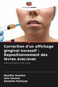 Correction d'un affichage gingival excessif