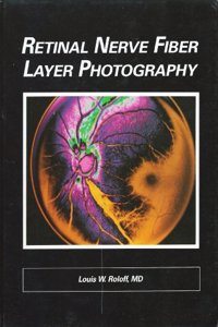 Retinal Nerve Fibre Layer Photography