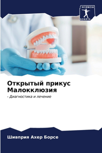 Открытый прикус Малокклюзия