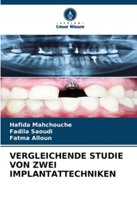 Vergleichende Studie Von Zwei Implantattechniken
